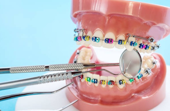 Las Mejores Dentistas en Ortodoncia de Madrid LosMejoresDeMadrid ® 1