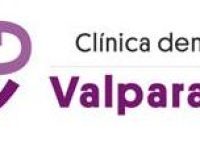 clinica dental valparaiso-2484
